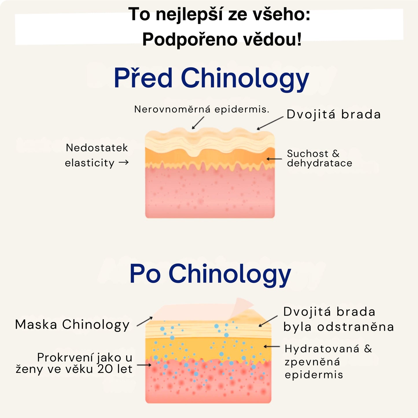 Chinology™ Lift – Zdvojnásobujeme vaši objednávku JEN DNES!